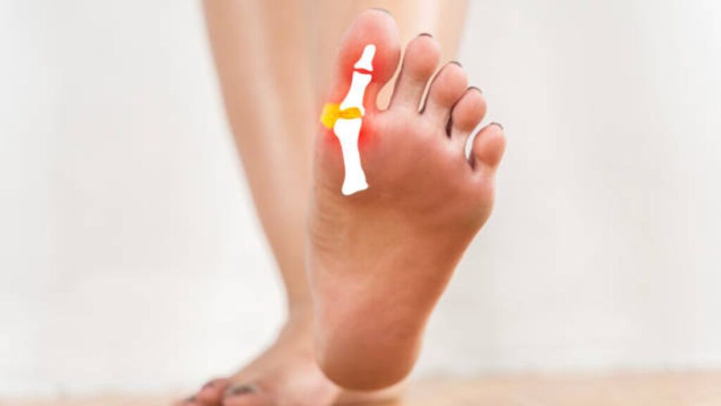 kin logo ko chukandar nahi khana chahiye