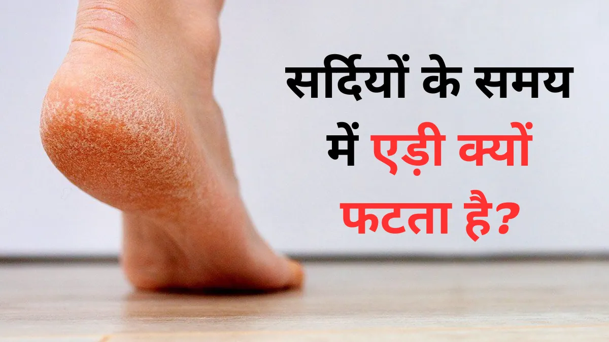 Fati Ediyon Ke Liye Gharelu Upay